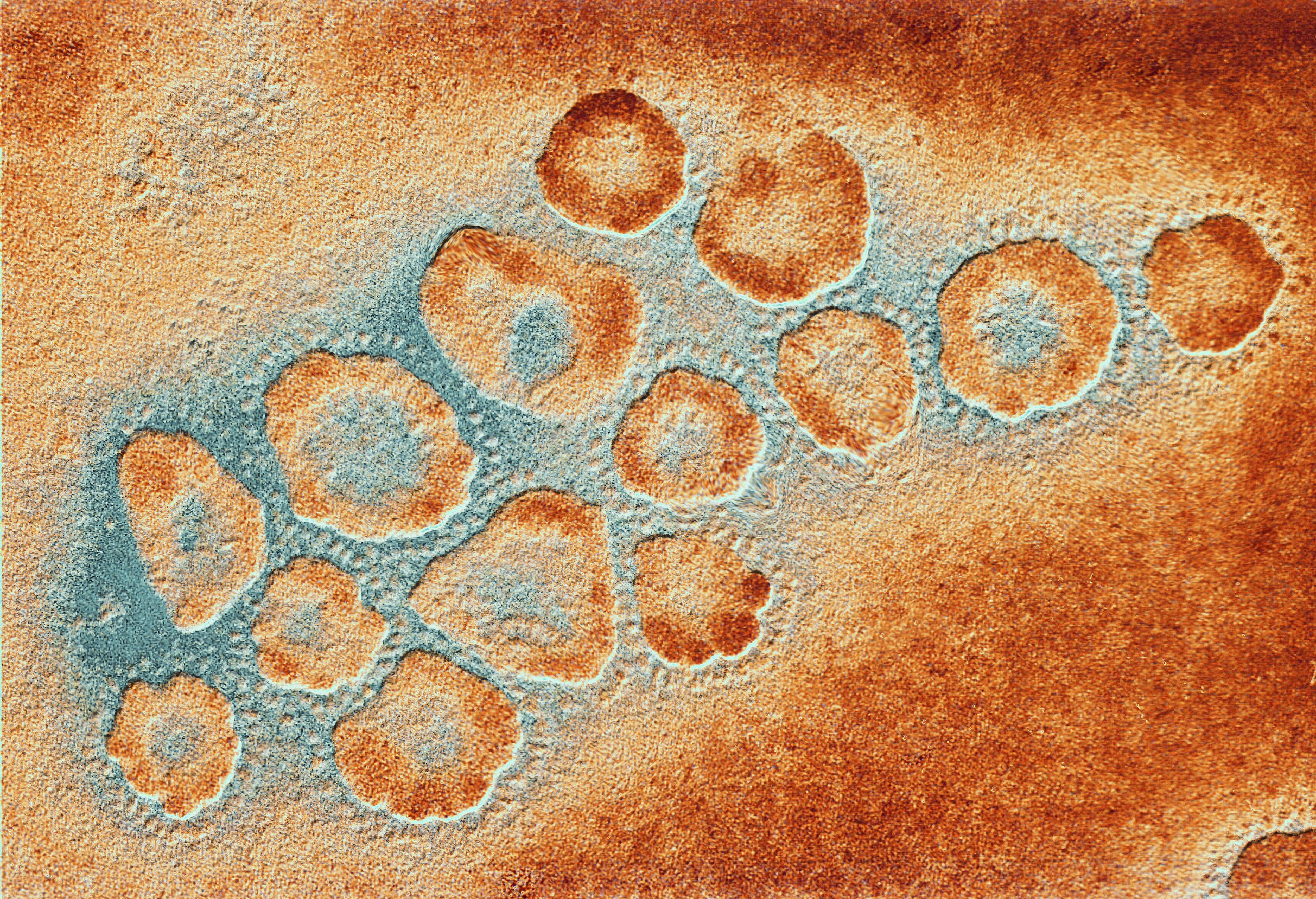 TEM of a cluster of corona viruses